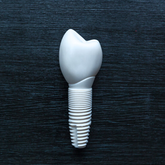 dental implant